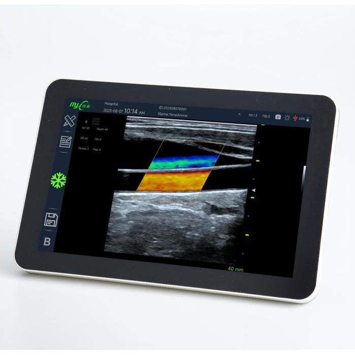 Fast Scan OPU with veterinary doppler blood pressure monitor