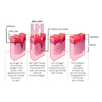 pdt led light therapy beauty machine