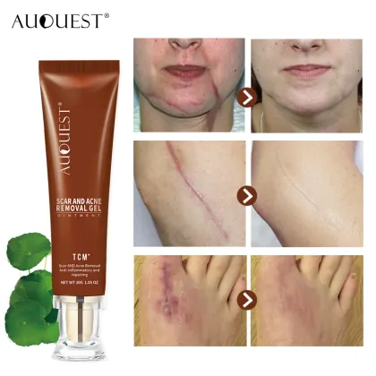 TCM South Korea Factory - Private Label Scar Removal & Pimple Cream