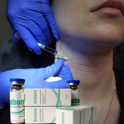 Fillers For Face Rejuvenation Improve Slack Skin Fillers Factory
