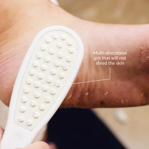 Steel Remove Callus Pedicure Foot File