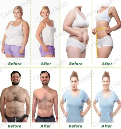 Digestive Enzyme Weight Loss Slimming Capsules
