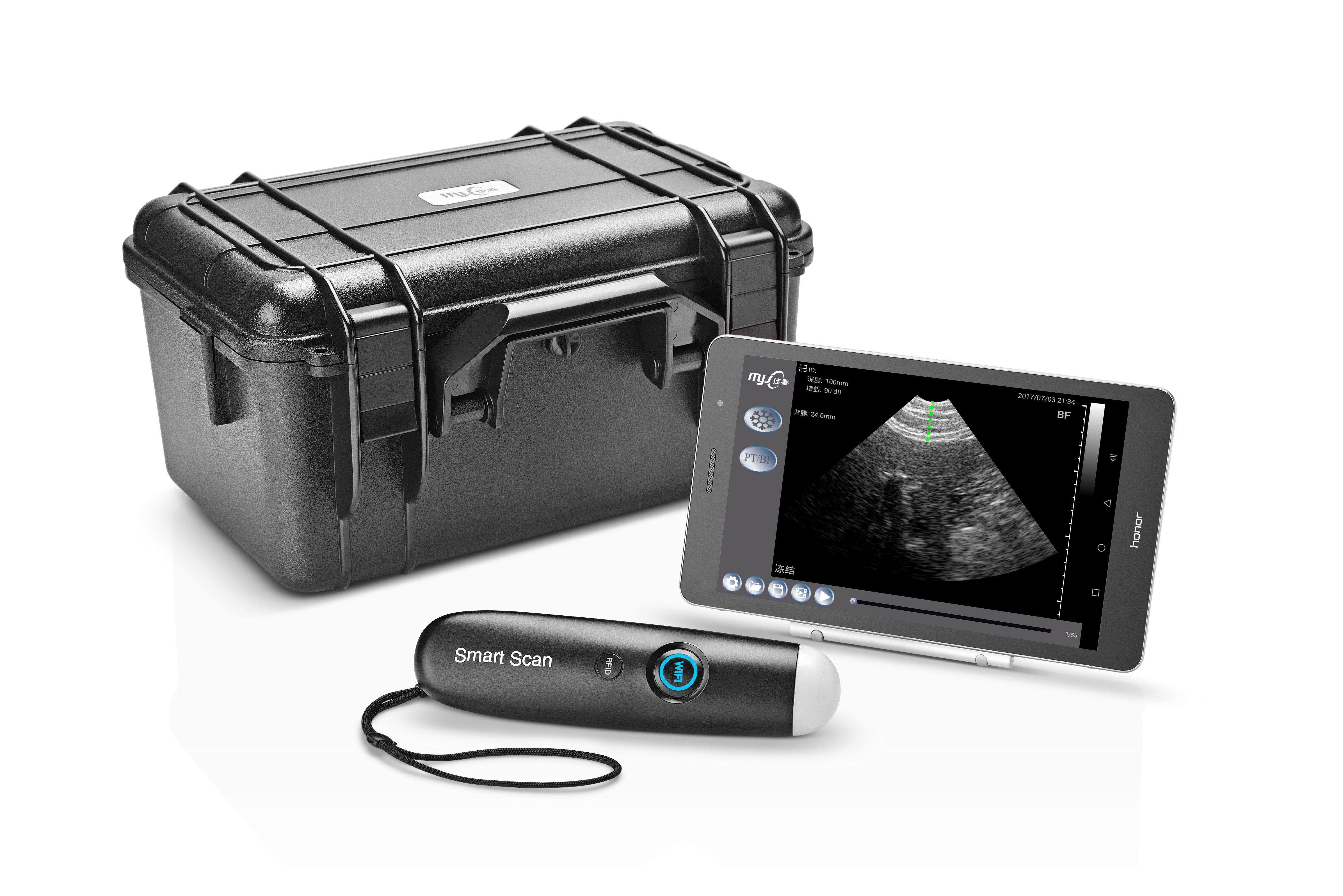 portable wireless ultrasound
