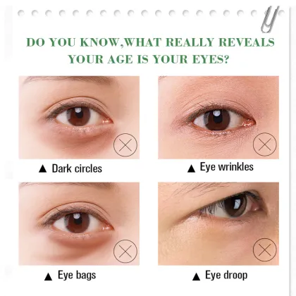 Aichun Beauty Best Moisturizer: Remove Dark Circles and Eye Bags, Anti-Wrinkle Eye Cream