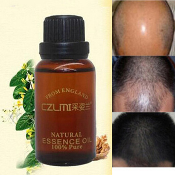 Boost Hair Growth Loss Products Anti Bald Alopecia Hair Loss Remedies 100% Natural Herbs Anti Hair Loss Treatment