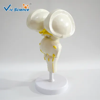 Brain stem amplification model