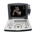 Black and White Ultrasound Scanner,Built-in Battery