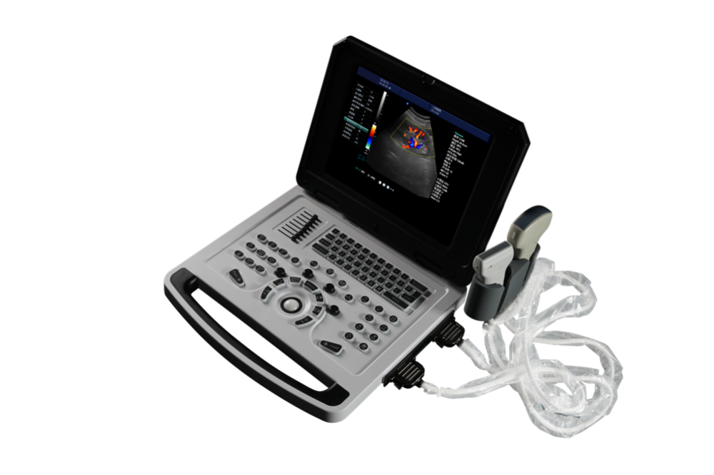 Scanner de ultrassom Doppler colorido de notebook para obstetrícia