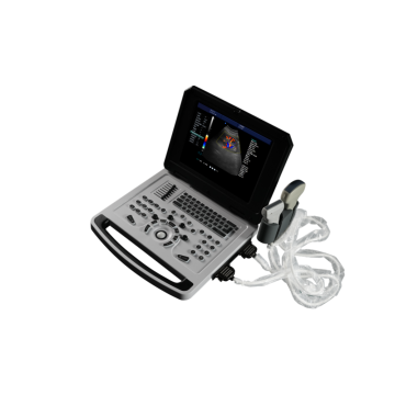 Escáner de ultrasonido Doppler de color cuaderno para obstetricia