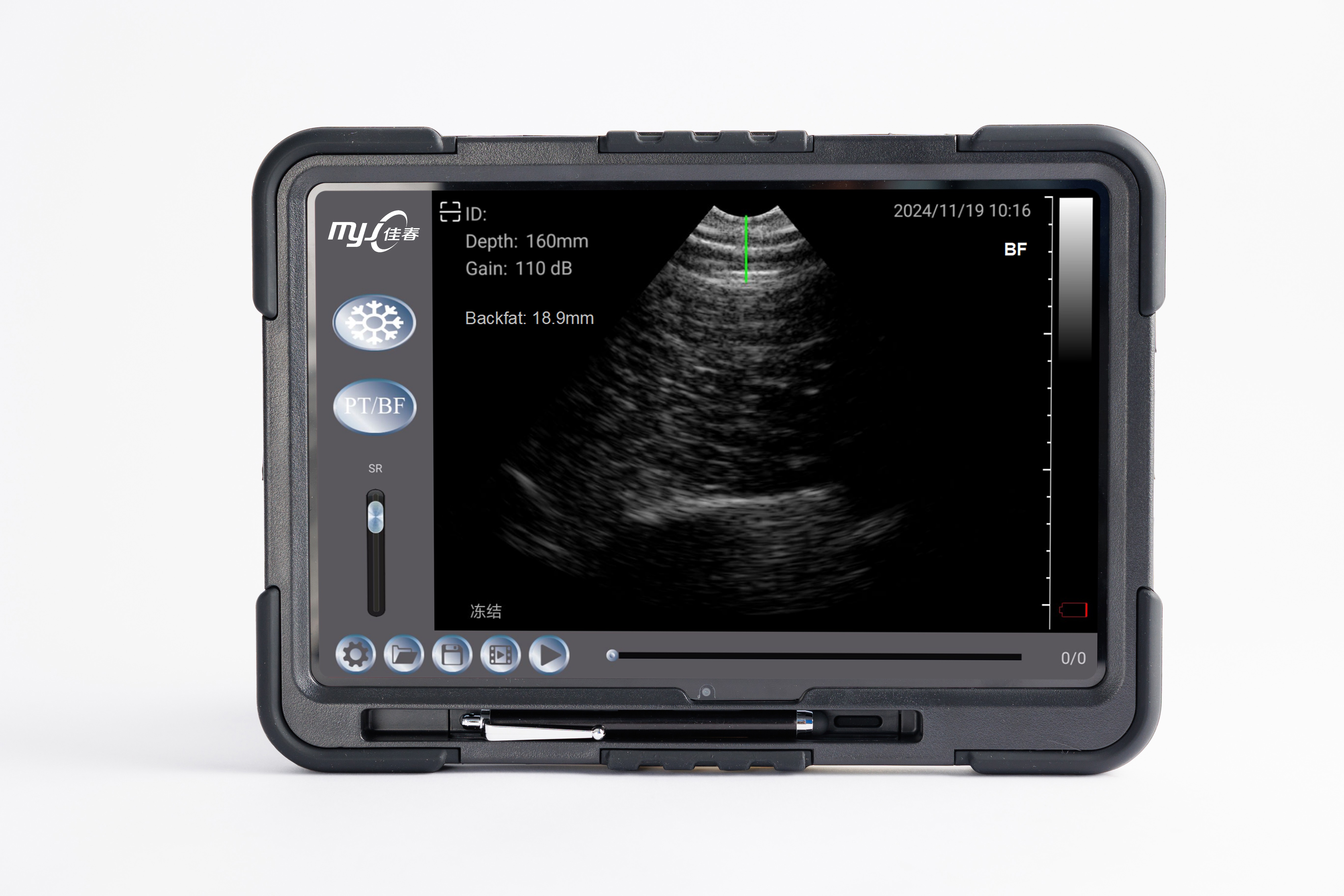wireless ultrasound
