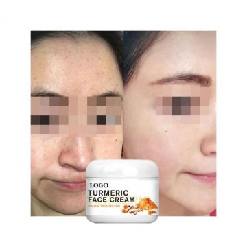 Turmeric Face Moisturizer: Chinese Whitening Cream for Black Skin
