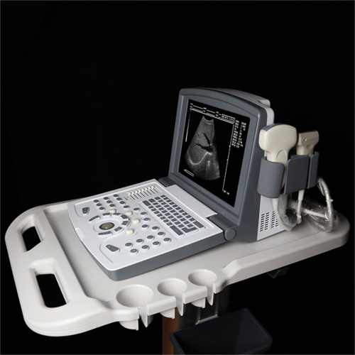 Bärbar B-Ultrasound-skanner med dragprober