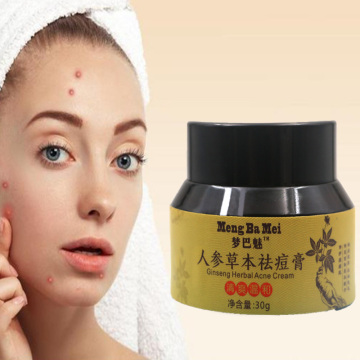 Anti Acne Spots Natural Organic Cream Cosmetic