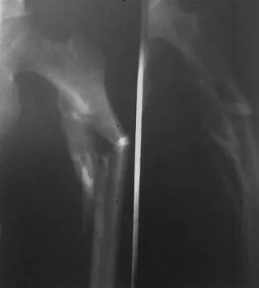 25cm×30cm Thermal Printer Film , Fuji Medical Dry Imaging Film