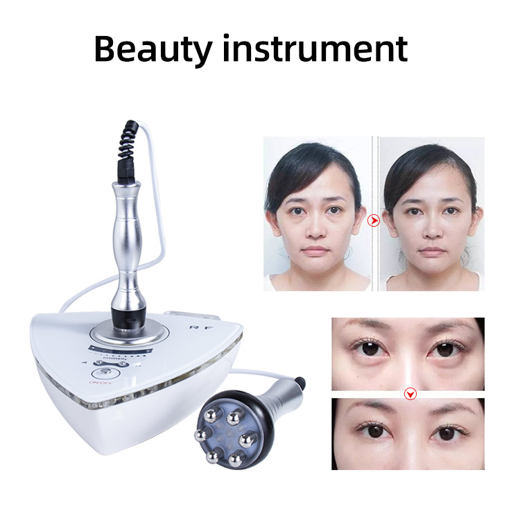 radio frequency face lift