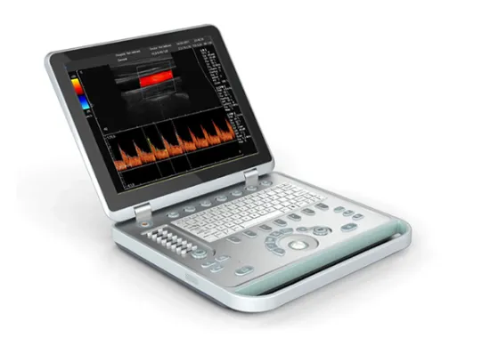 Portable laptop ultrasound machine For Clinic