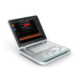 Portable laptop ultrasound machine For Clinic