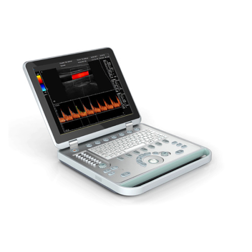 Portable laptop ultrasound machine For Clinic