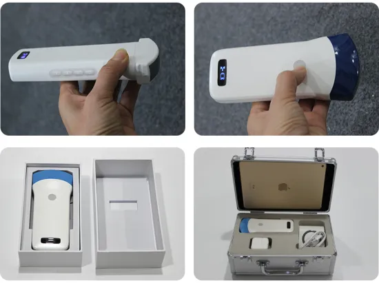 Wireless Portable Color Doppler Ultrasound Scanner