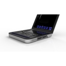 Мабільны доплераграфічны ўльтрагукавы даследаванне