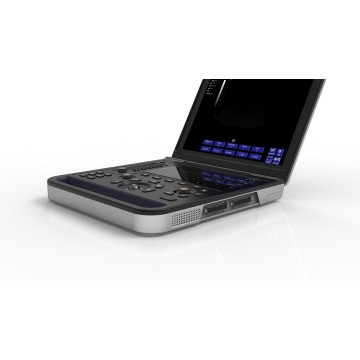 Дыягнастычнае ўльтрагукавое абсталяванне для абследавання сэрца