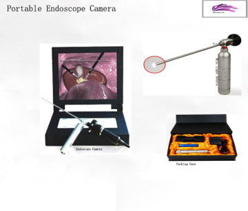 portable endoscope equipment