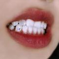 Adorno de diamantes dentales varias gemas de cristal con forma