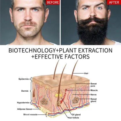 Factory Low Moq OEM Natural Plant Men's Beard and Mustache Growth Oil