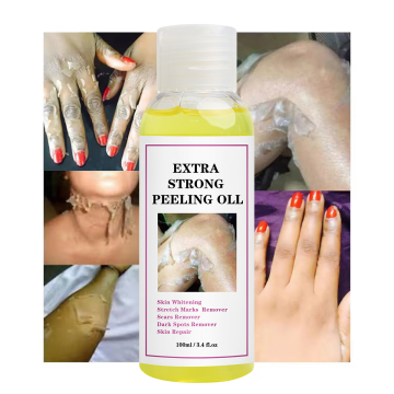 Private Label Dark Knuckles Skin Peeling Solution - Extra Strength Whitening Treatment