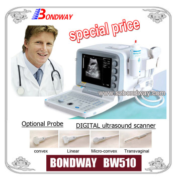 Digital Portable Ultrasound Scanner Medical Equipment Diagnostic Imaging System