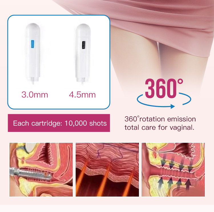 hifu ultrasound