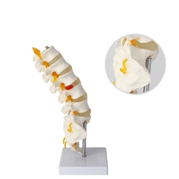 Lumbar Spine Model: 5 Vertebrae with Discs, Nerves, and Spinal Cord
