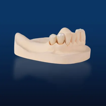 Zirconia Veneered Whitening Device