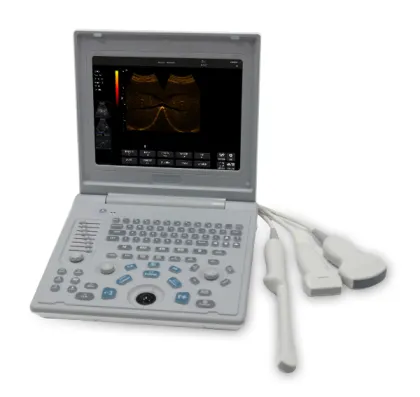 Sonostar SS-6B Ultrasound Machine