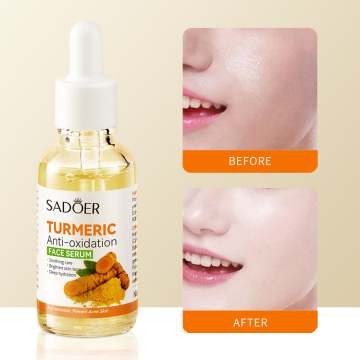 Turmeric Facial Serum Moisturizing Anti Wrinkle Essence