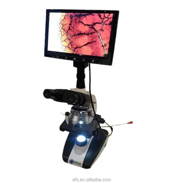 Trinocular Digital Microscope with LCD Screen: C108-THD7