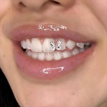 Adorno de diamantes dentales varias gemas de cristal con forma