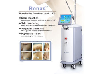 Fractional Laser Skin Resurfacing Machine , Ergeture Treatment