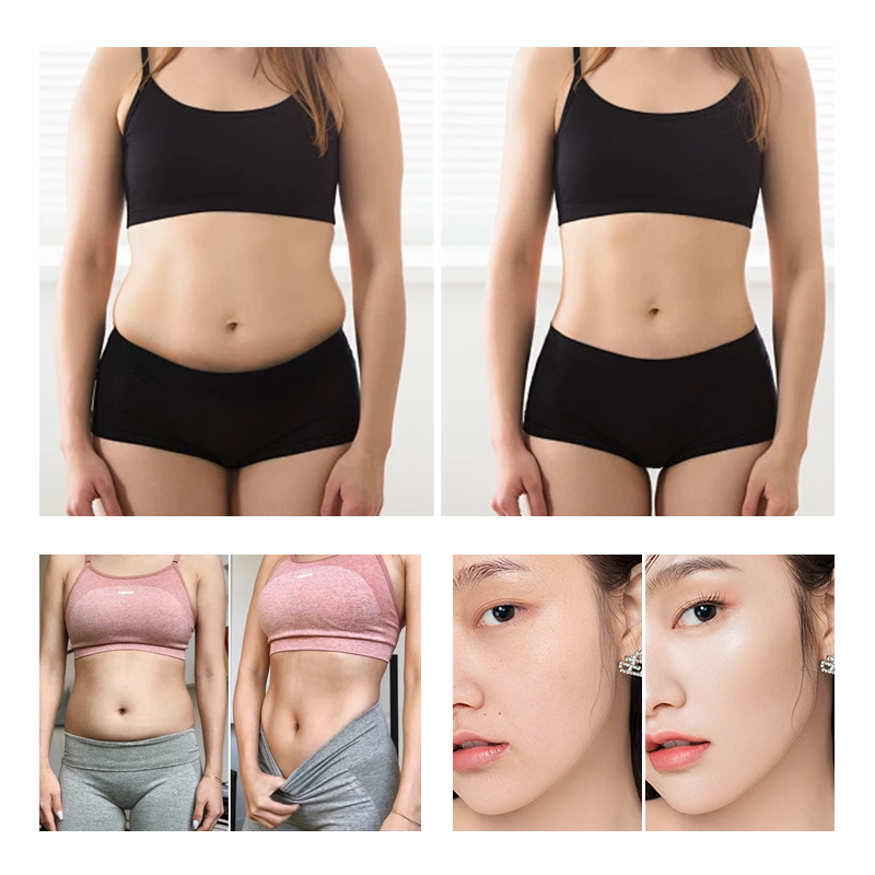 Ultrasonic beauty device