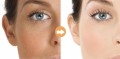 Certificat MSDS de vente chaude Soins de la peau Anti-acné Réduire les ridules Crème pour le visage à la racine de curcuma