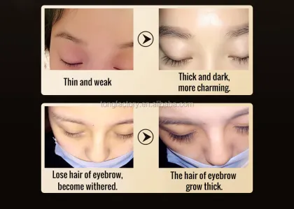 Advanced Herbal Eyebrow Growth Serum - 7 Day Effective Formula