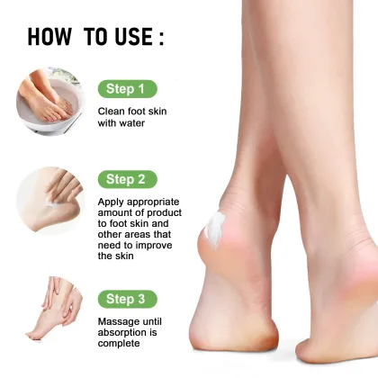 Private Label Dead Skin Removal Foot Cream: Whitening, Repair, Moisturizing & Exfoliation