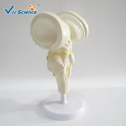 Brain stem amplification model