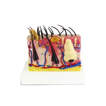 Canine Skin with Flea Bite Anatomical Model - Dog Skin Model