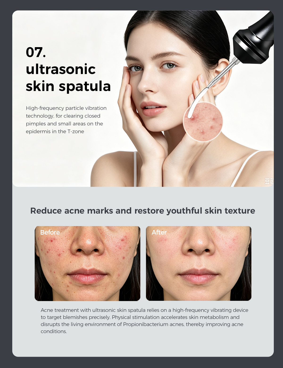 beauty device