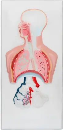 Respiratory relief model