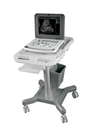 B/W ultrasound machine Notebook B Ultrasound Scanner