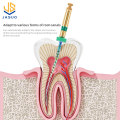 Dental Products Root Canal Files Dental Endo File Endodontic