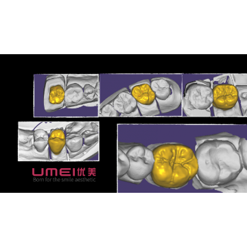 Full Mouth Teeth CAD Design