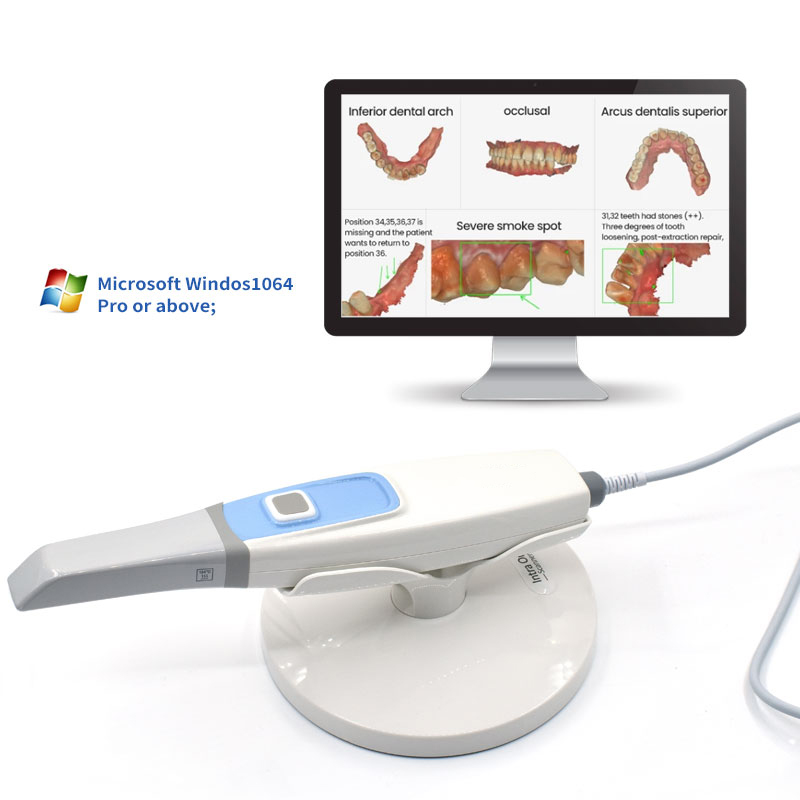 Escáner dental dental digital escáner oral portátil